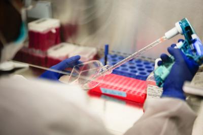 Researcher measures volume of cell cultures for an experiment.