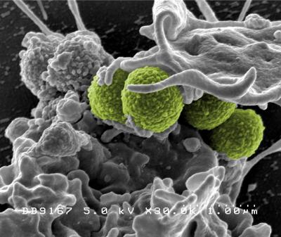 Scanning electron micrograph of methicillin-resistant Staphylococcus aureus (MRSA) bacteria (colorized green) interacting with a human neutrophil. The bacteria shown is strain MRSA252, a leading cause of hospital-associated infections in the U.S. and U.K. Image captured at NIAID's Rocky Mountain Laboratories (RML) in Hamilton, Montana.