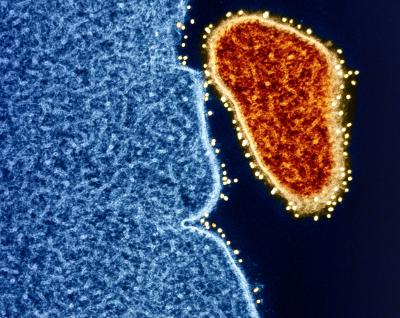 Colorized transmission electron micrograph of an extracellular Nipah virus particle (red) on the periphery of an infected VERO E6 cell (blue). Nipah virus surface glycoproteins have been identified using a technique called “immunogold labeling,” in which gold particles (yellow) are bound to antibodies that recognize a specific viral antigen or epitope. Captured at the NIAID Research Facility in Fort Detrick, Maryland.