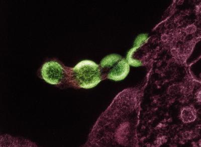 Several green spheres bound together in a line and budding from irregular matter.