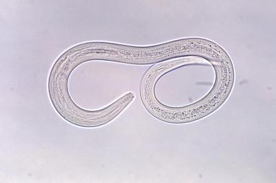 two loops show micrograph of parasitic worm larva