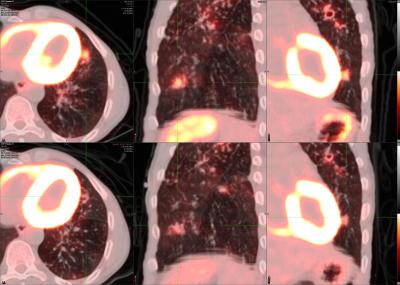 Photo of PET/CT imaging