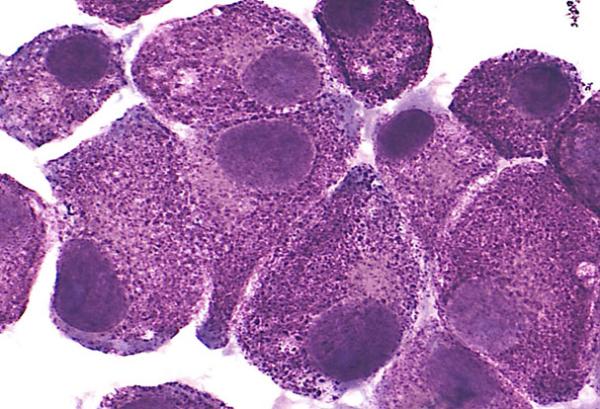 LAD2 mast cells.