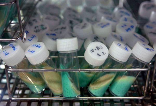 Sputum cultures from tuberculosis patients. Sputum often is used to detect and identify bacteria in the lungs.