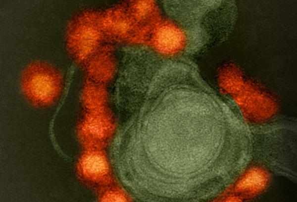 Transmission electron microscope image of negative-stained, Fortaleza-strain Zika virus, isolated from a microcephaly case in Brazil