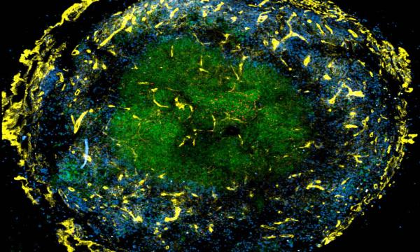 Cellular organization of a granuloma from a M. tuberculosis infected rhesus macaque. blue = CD4+ T cells, green = CD11b+ myeloid cells, yellow = laminin, red = M. tuberculosis