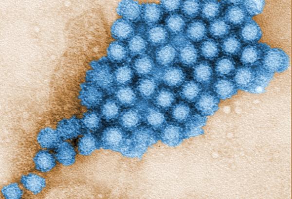Transmission electron micrograph of norovirus particles.