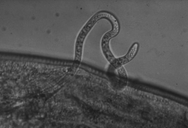 An O. volvulus parasite emerges from an infected blackfly.