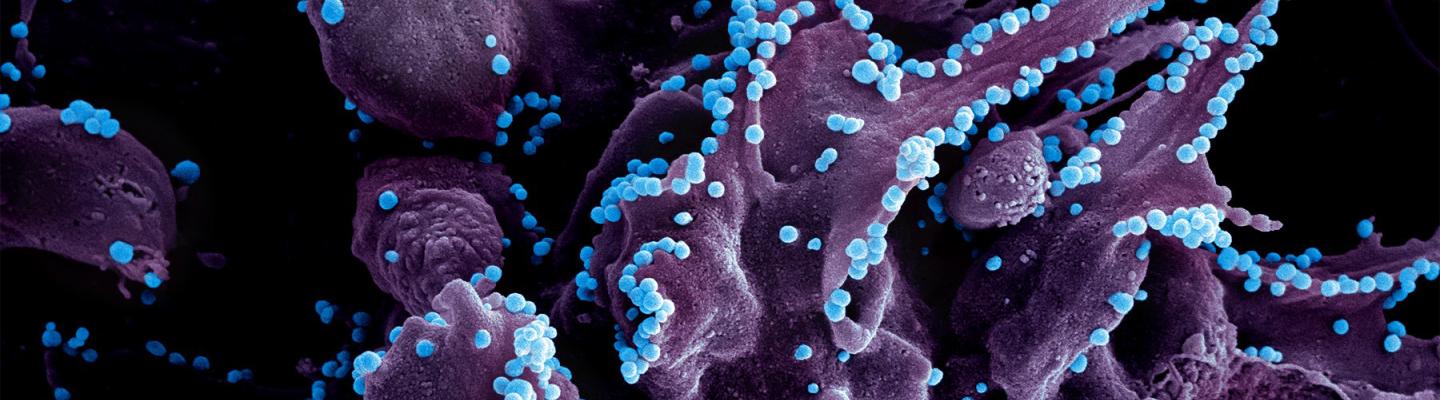 Colorized purple and blue scanning electron micrograph of Lassa virus