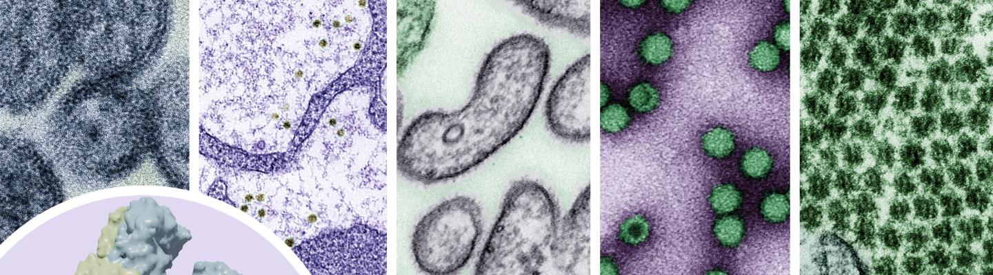 Five side by side images of different viruses.