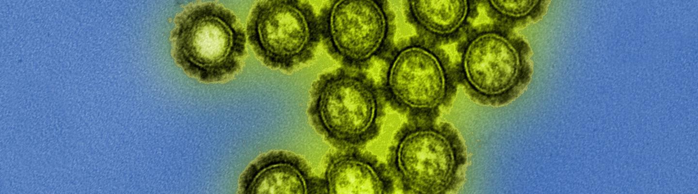 H1N1 Influenza Virus Particles