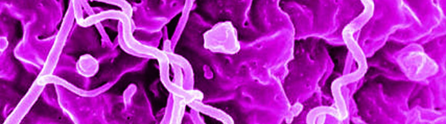Image of syphilis bacteria