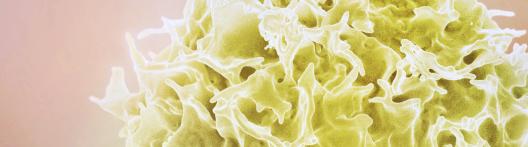 pink background, yellow T cell 