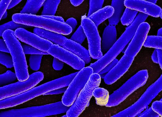 Image of E. coli bacteria