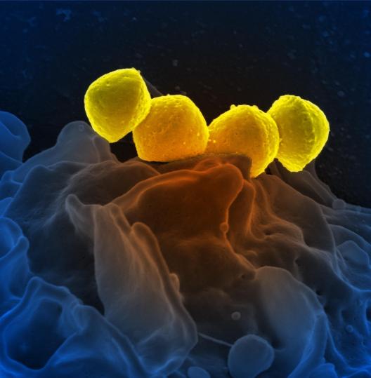 NeutrophilScanning electron micrograph of Group A Streptococcus