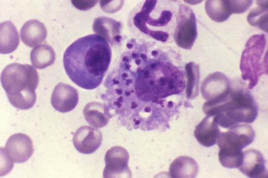 Leishmaniasis hero image
