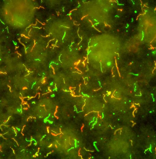 Lyme Disease Bacteria, Borrelia burgdorferi