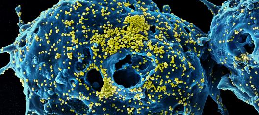 MERS virus cells