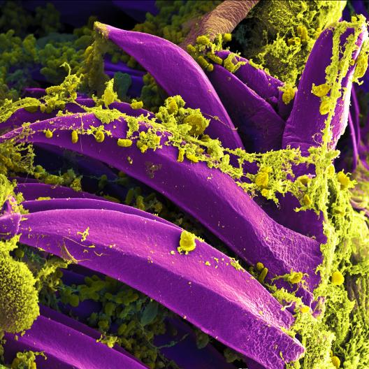Scanning electron micrograph showing Yersinia pestis, which causes bubonic plague