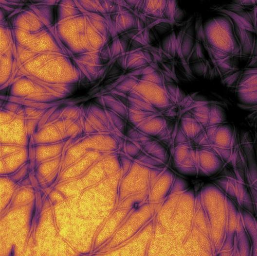 Prion protein fibrils