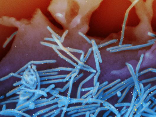 Colorized scanning electron micrograph of human respiratory syncytial virus (RSV) virions (blue) and labeled with anti-RSV F protein/gold antibodies (yellow) shedding from the surface of human lung epithelial cells.