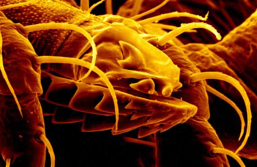 Tickborne Diseases image