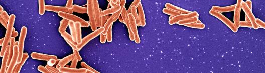 purple background with orange cylinders (TB particles) scattered and gathered around 
