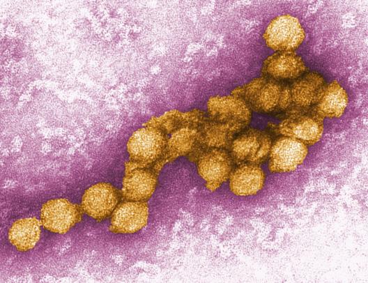 Image of West Nile Virus 