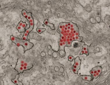 Zika virus particles shown in African green monkey kidney cells
