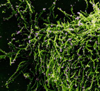 This image shows a colorized scanning electron micrograph of a cell (green) infected with a variant strain of SARS-CoV-2 virus particles (purple).