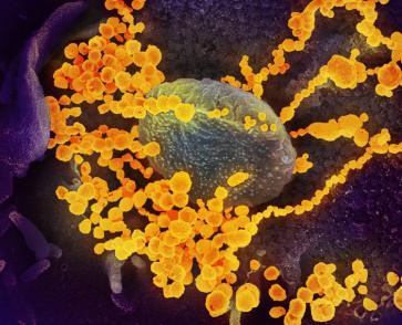 SARS-CoV-2, the virus that causes COVID-19.