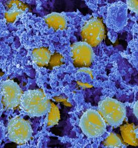 Scanning electromicrograph of Staphylococcus aureus bacteria.