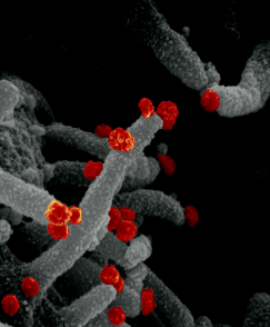 This scanning electron microscope image shows SARS-CoV-2 (round red particles) emerging from the surface of a cell cultured in the lab.