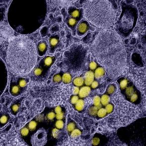 SARS-CoV-2 virus particles