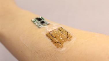 prototype of a smart bandage equipped with temperature and pH sensors