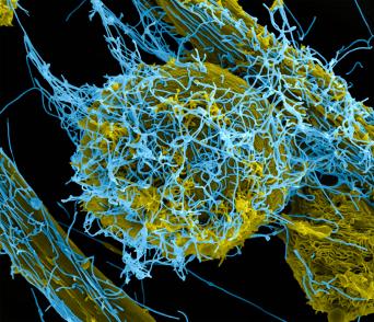 Colorized scanning electron micrograph of Ebola virus particles both budding and attached to the surface of an infected VERO E6 cell