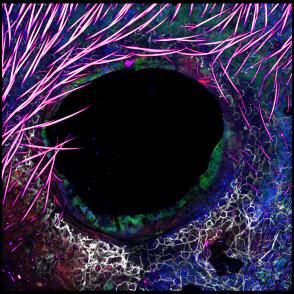 CD8 T Cells Close to Wound After Staphylococcus Epidermidis Application
