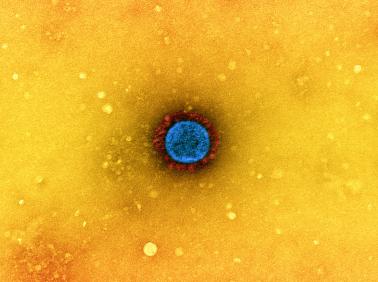 Transmission electron micrograph of a SARS-CoV-2 virus particle
