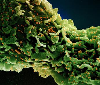 Colorized scanning electron micrograph of a cell infected with a variant strain of SARS-CoV-2 virus particles (UK B.1.1.7), isolated from a patient sample.