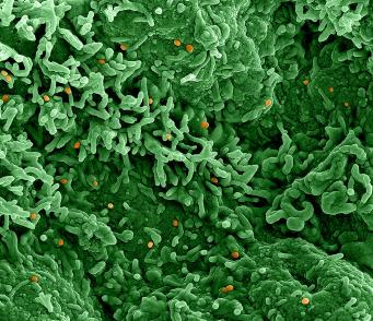 Colorized scanning electron micrograph of mpox virus on the surface of infected VERO E6 cells