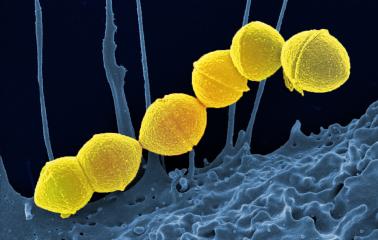 Colorized scanning electron micrograph of Group A Streptococcus (Streptococcus pyogenes) bacteria and a human neutrophil.