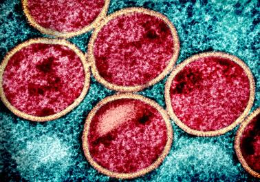 Circular particles (red surrounded by tan) on a teal background