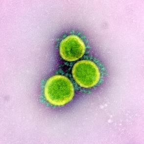 A transmission electron micrograph of three circular SARS-CoV-2 virus particles, colored green in this image, against a lilac background.