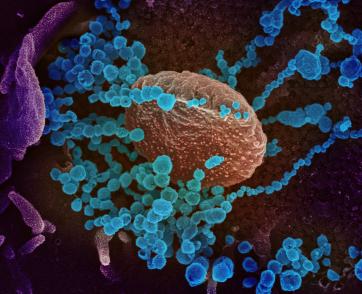 This scanning electron microscope image shows SARS-CoV-2 (round blue objects), the virus that causes COVID-19, emerging from the surface of cells cultured in the lab.