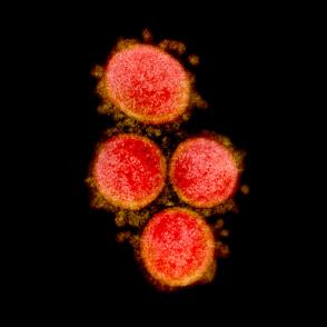 red circular virus particles with orange surface spikes