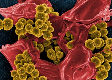 Methicillin-resistant Staphylococcus aureus bacteria
