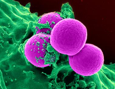 Colorized scanning electron micrograph of a human neutrophil ingesting MRSA.