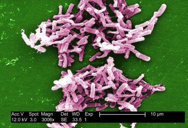 digitally-colorized scanning electron microscopic image depicts a large grouping of rod-shaped, Clostridium difficile bacteria that were cultured from a stool sample.