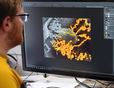 Visual artist colorizing a SARS-CoV-2 image