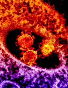 Colorized transmission electron micrograph showing particles of the Middle East Respiratory Syndrome Coronavirus that emerged in 2012.